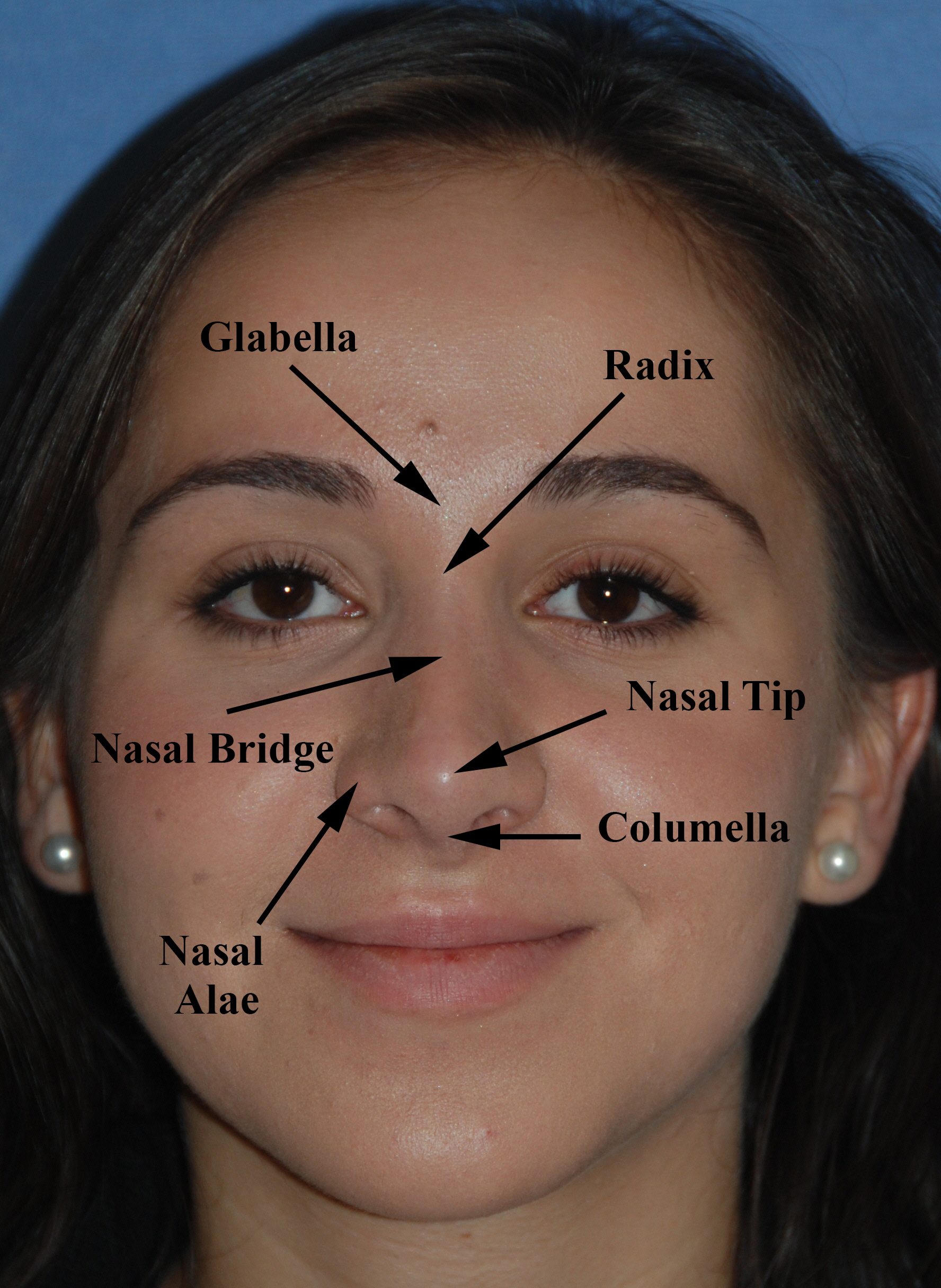 Rhinoplasty / Nose Surgery / Nose job / Nose Reshaping / Nasal