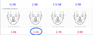 Line Drawings: Lower Lip was Found to Be Ideally 1 iris width in Height