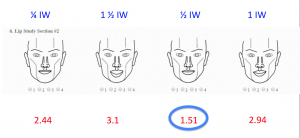 Line Drawings: Upper Lip was Found to Be Ideally 1/2 iris width in Height