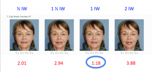 Morphed Actual Real Life Pictures: The Lower Lip is Ideally One Iris Width in Height