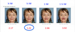 Morphed Real Life Pictures: Upper Lip was Found to Be Ideally 1/2 Iris Width in Height